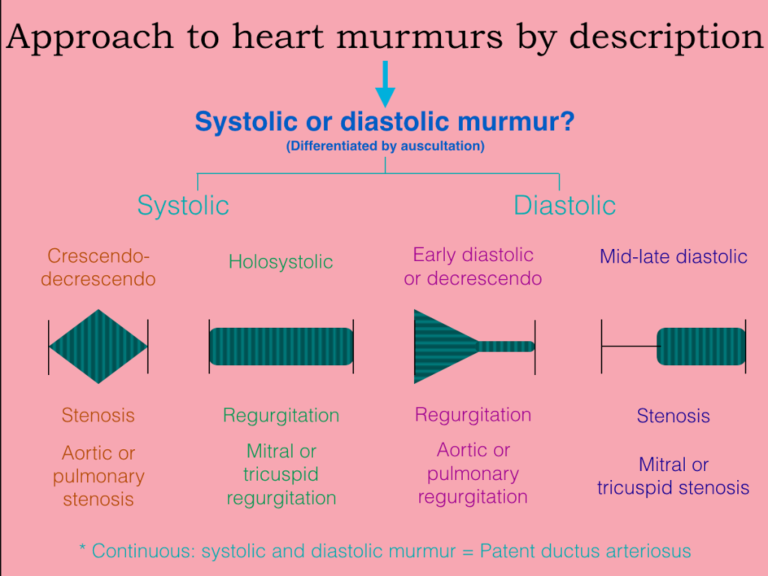 USMLE Approach to heart murmur questions