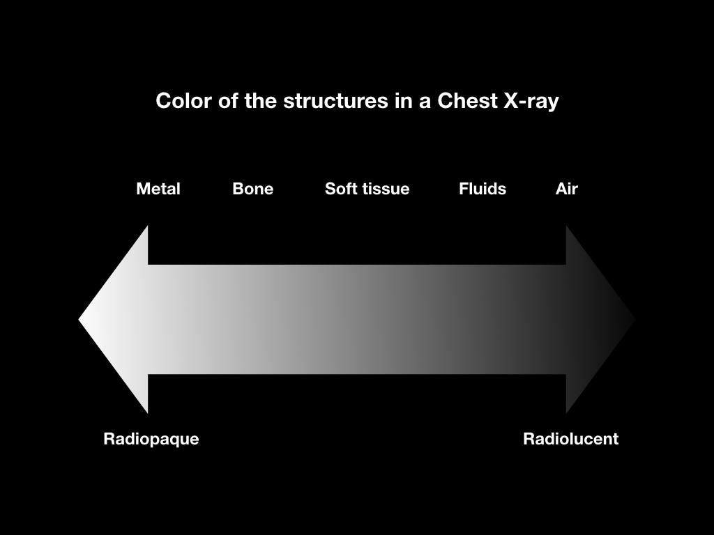 Density in an x-ray film