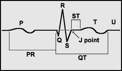 J point
